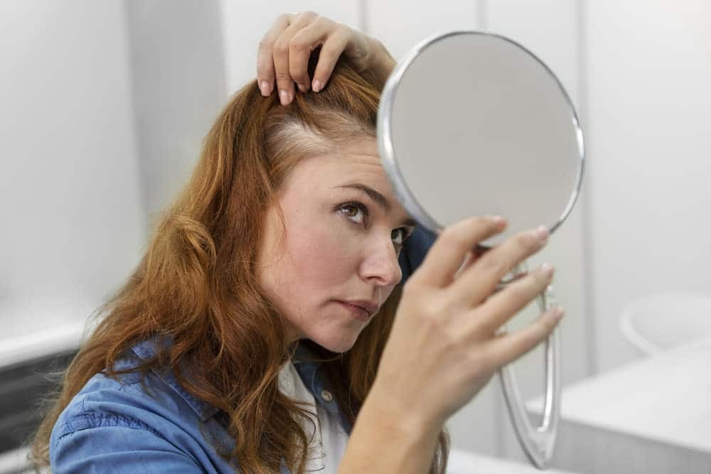 Tipos de alopecia