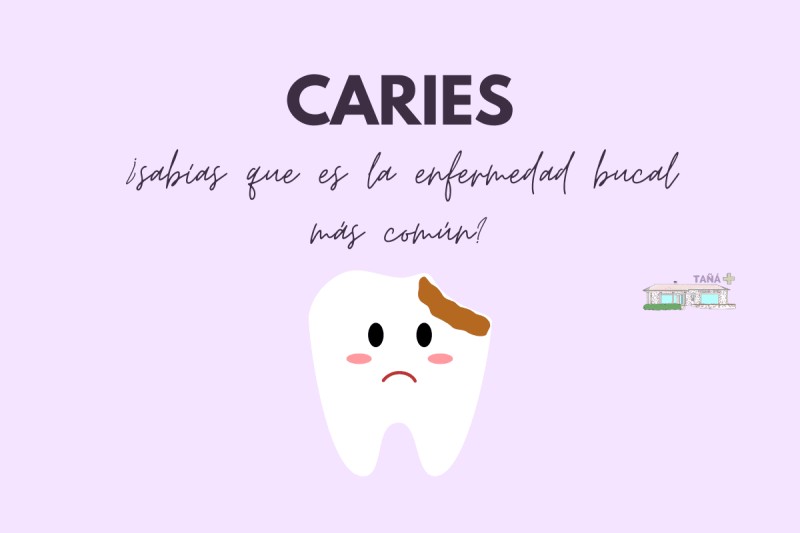 caries