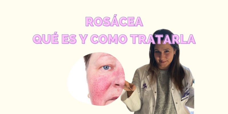Rosácea