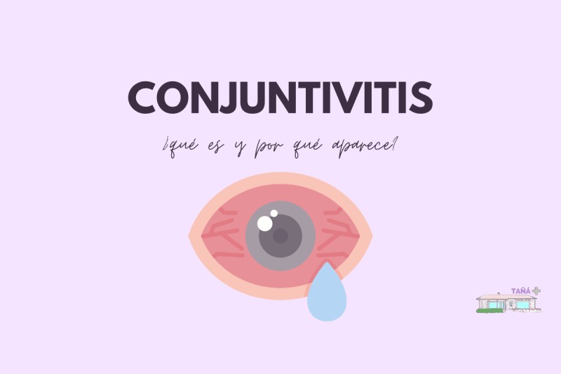 conjuntivitis